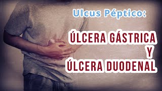 ÚLCERA GÁSTRICA Y DUODENAL Definición causas Diagnóstico diferencial y Tratamiento [upl. by Mccullough]