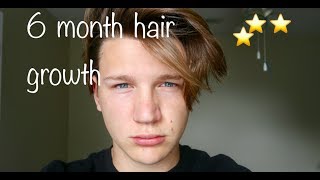 Mens hair 6 MONTH HAIR GROWTH [upl. by Perkoff941]