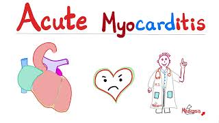 Acute Myocarditis — Causes Symptoms Diagnosis amp Treatment — Cardiology [upl. by Delora794]