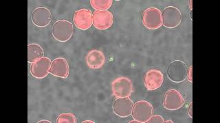 Babesia bovis merozoite egress from a red blood cell [upl. by Kimber]