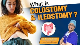 What is colostomy amp ileostomy  Stoma Bag Kya hai Dr Neeraj Goel [upl. by Anairotciv]