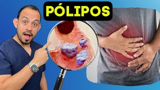 10 DATOS IMPORTANTES sobre Pólipos en el Colon Síntomas Causas Estudios Tratamiento y Prevención [upl. by Bowra]