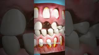 How Adult Teeth Grow In 🤔 [upl. by Morley]