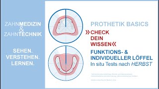 Check Dein Wissen  Funktionslöffel individuelle Löffel im Mund in situ  Tests nach HERBST [upl. by Atteragram]