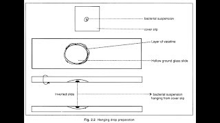 Hanging Drop PreparationPositive [upl. by Nevets541]