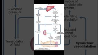 Pathophysiology Of Ascites  Portal Hypertension medical [upl. by Ahsenik]