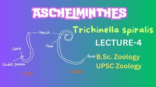 Aschelminthes  Trichinella spiralis Parasitic helminthes  Zoology  Notes in Description [upl. by Uticas]