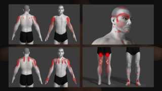 trigger point explained with animation [upl. by Ecneitap]