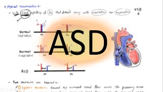 Atrial Septal Defect  ASD  Pediatrics cardiology  شرح بالعربي [upl. by Aruam]