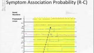 Acoustic Cough Reflux Associations in Chronic Cough [upl. by Assyn551]