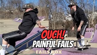 Broken Bones amp PAINFUL Fails  Fails Compilation [upl. by Kliment]