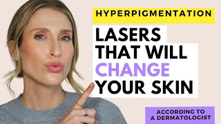 The Best Laser Treatments for Hyperpigmentation  Dr Sam Ellis [upl. by Andreas481]