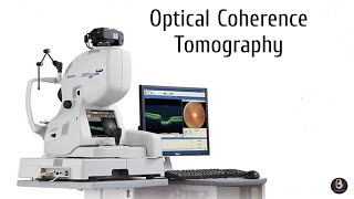 Optical Coherence Tomography  Biomedical Engineers TV [upl. by Llemhar]