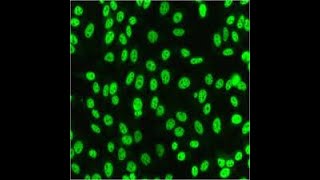 IIFANA STAINING PATTERNS INTERPRETATION  ANTINUCLEAR ANTIBODIES TESTING OF AUTOIMMUNE DISORDERS [upl. by Baptist]