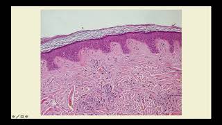 Basics of Dermatology Part One  CRASH Medical Review Series [upl. by Nikral]