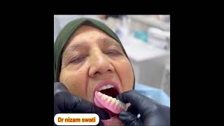 dental full denture procedure [upl. by Aivatal773]