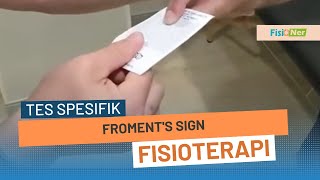 Froments sign [upl. by Ennaj]