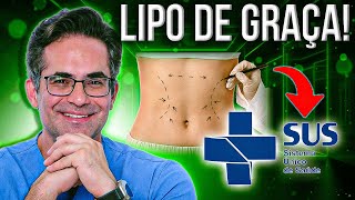 Como fazer sua CIRURGIA PLÁSTICA PELO SUS [upl. by Marge]