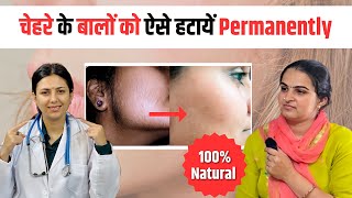 Facial Hair को किया बिना Laser के ठीक  Patient Review Hirsutism Ayurvedic Treatment 100 Results [upl. by Marja340]