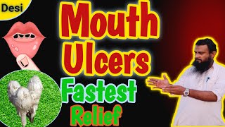 munh ke chhale  How to Heal Mouth Sores Faster  mouth ulcers [upl. by Sadoff]