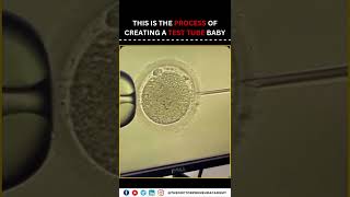 IVF A Journey to Parenthood Through Advanced Fertility Solutions [upl. by Goldstein402]