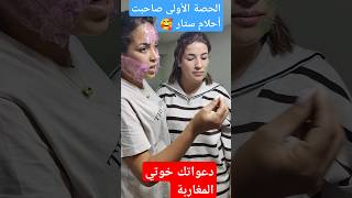 الحصة الأولى عند حنان إزالةالكلف اكسبلور ازالةالتجاعيد تيكتوك ترند tattoo [upl. by Hadik]