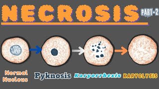 “Nuclear Metamorphosis Exploring Pyknosis Karyorrhexis and Karyolysis” Necrosis part 2 [upl. by Skilken544]