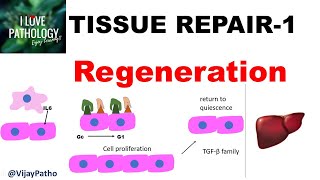 TISSUE REPAIR Part 1 Repair  Regeneration [upl. by Towbin]