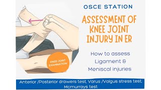 Examination of Knee Joint  Assessment of a knee joint injury  OSCE station [upl. by Yenahc]