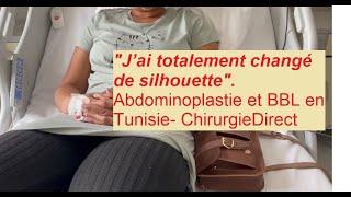 J’ai totalement changé de silhouette suite à mon abdominoplastie et BBL en Tunisie Chirurgiedirect [upl. by Etteinotna940]