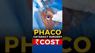 Phaco Cataract Surgery Cost [upl. by Muriah534]