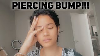 How To Get Rid Of Piercing Bumps FAST KeloidPiercing Bump [upl. by Allenrac]