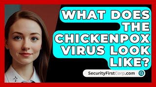 What Does the Chickenpox Virus Look Like  SecurityFirstCorpcom [upl. by Vitus]