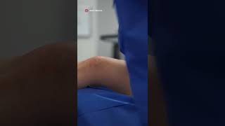 Watch our experts perform a minimally invasive varicose vein removal procedure varicoseveins 2024 [upl. by Procora]