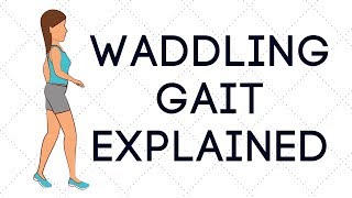 Waddling Gait Explained [upl. by Hayashi]