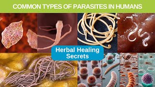 Common Parasites In Humans And Where They Come From [upl. by Huff]