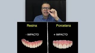 DENTADURA FIXA DE PORCELANA OU RESINA [upl. by Chew]