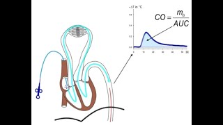 Is TPTD Transpulmonary Thermodilution Obsolete in context of POCUS [upl. by Adnohsel45]