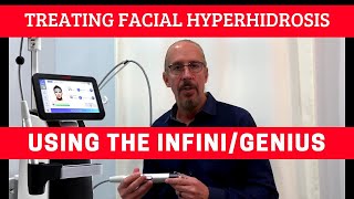 Treating Facial Hyperhidrosis Using The InfiniGeniusRF Microneedling With Long Term Results [upl. by Engedus889]