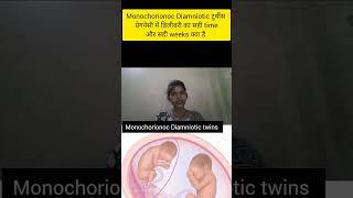 monochorionoc Diamniotic twins pregnancy me delivery ka sahi time kya hota h shortstwinsdelivery [upl. by Atinauj]