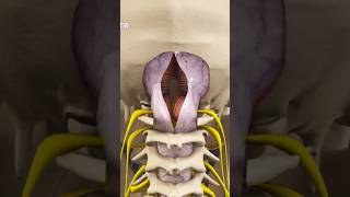 Chiari Decompression Surgery [upl. by Hill]