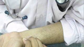 3 Finger Palpation of Radial Pulse [upl. by Ward]