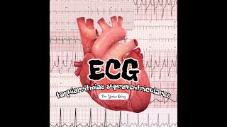 ECG y taquiarritmias supraventriculares I Academia de Fisiología UABC Mexicali [upl. by Boswell827]