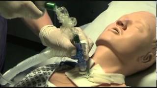 Closed suction of a tracheostomy tube [upl. by Kristoforo]