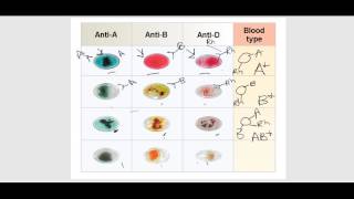 The Blood Part 3 Blood Typing and Transfusions [upl. by Clea]