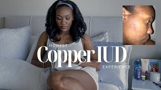 My HONEST Copper IUD Experience  BRUTAL Side Effects  PostPregnancy Family Planning [upl. by Delastre214]