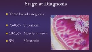 Bladder Cancer [upl. by Artemus]