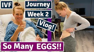 Process of Egg Retrieval in IVF  IVF Egg Retrieval Vlog [upl. by Aicetel]