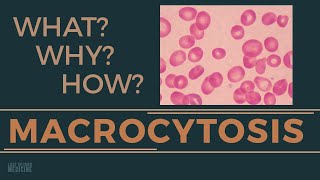 Macrocytosis  WHAT is it WHY is it Causes HOW to investigate  RAPID OVERVIEW OF MACROCYTOSIS [upl. by Nnyrat]