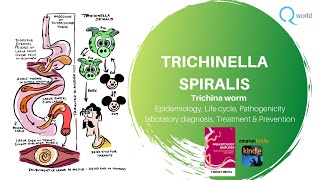 Trichinella Spiralis Parasitology simplified tutorials For NEXT USMLE NEET PG PLAB [upl. by Araeit]